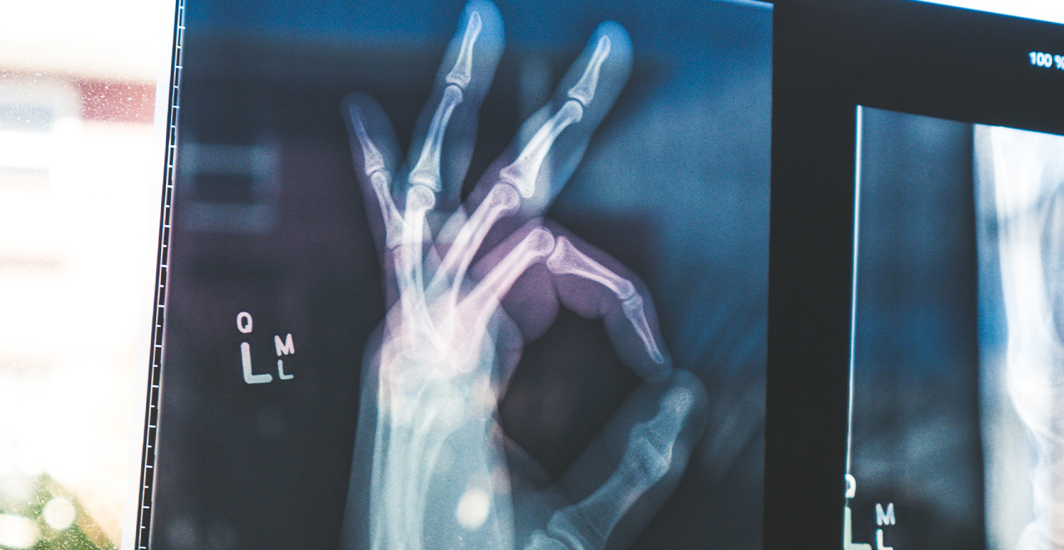 X-ray of hand giving "okay" sign
